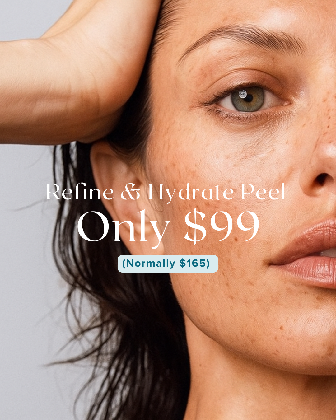 Refine & Hydrate Peel - with Wilma