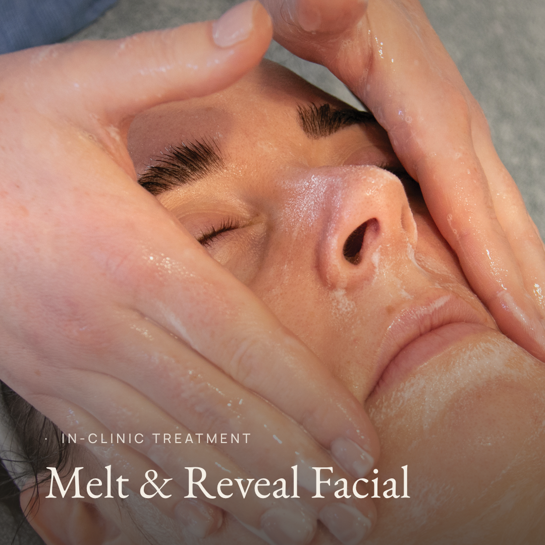Melt & Reveal Peel Treatment - Introductory Offer