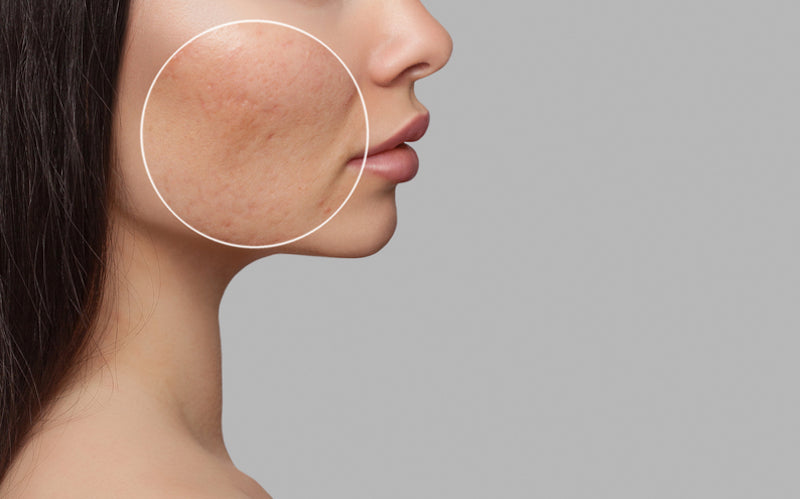 Non-surgical skincare for seniors